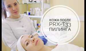Что такое пилинг PRX-T33 и как проходит процедура (ВИДЕО) для вашей кожи