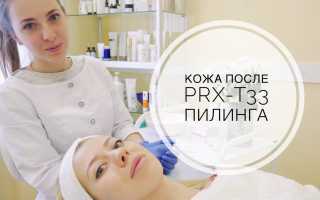 Что такое пилинг PRX-T33 и как проходит процедура (ВИДЕО) для вашей кожи