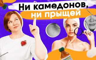 Как избавиться от закрытых комедонов надолго? Полезные советы и рекомендации