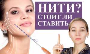 Что такое нитевой лифтинг лица и зачем «притягивать кожу за уши»? Узнайте все детали