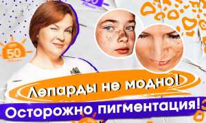 Как выбрать средство от пигментных пятен на лице? Полезные советы и рекомендации.