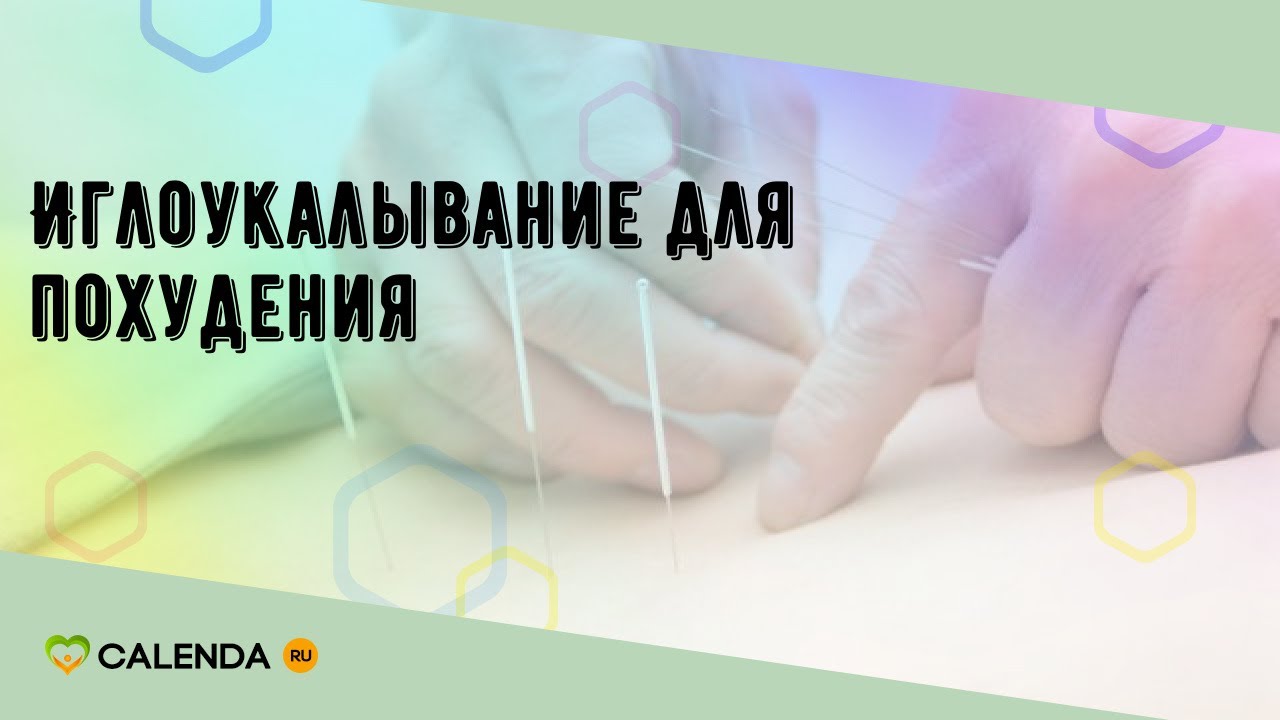 Иглоукалывание для похудения