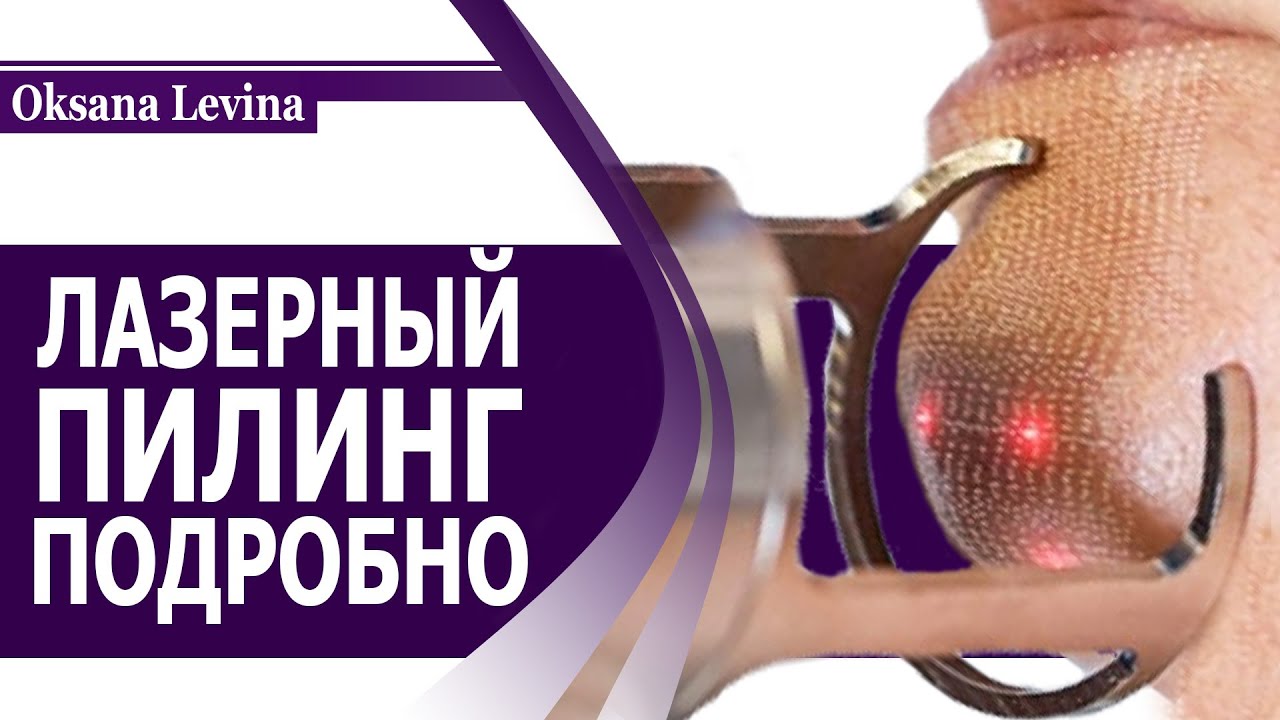 Чем полезен лазерный пилинг?