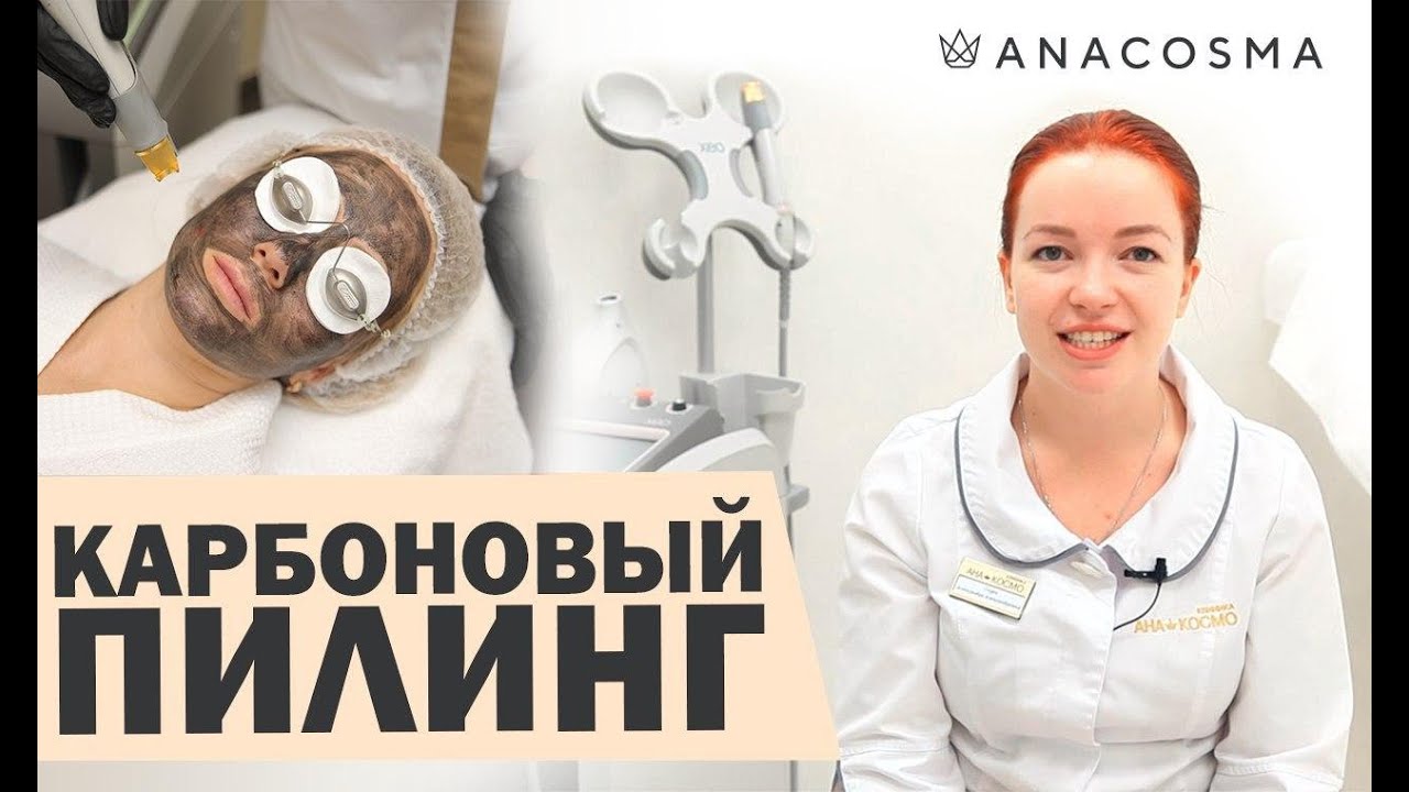 Карбоновый пилинг