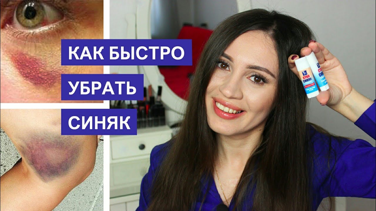 Как быстро избавиться от синяка на лице?