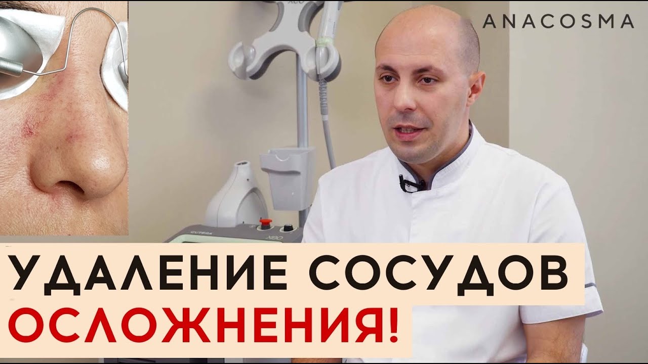 Как избавиться от сосудов на лице?