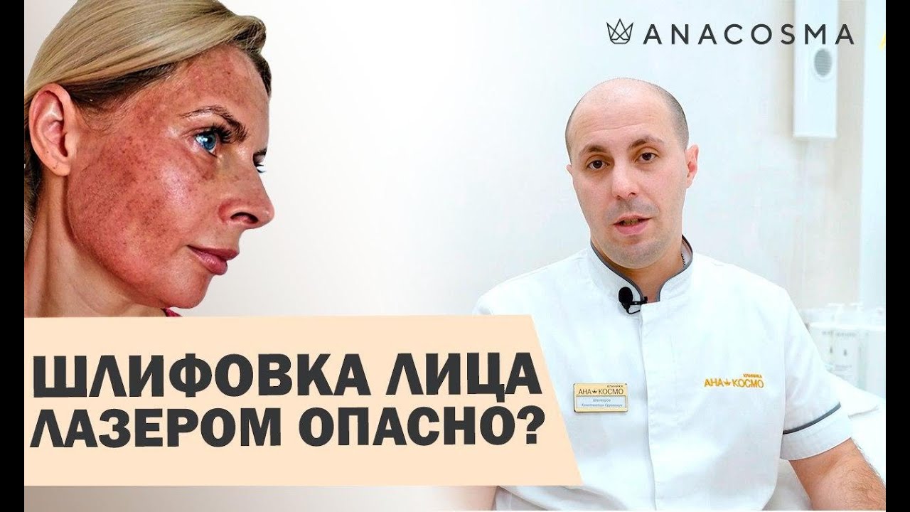 Лазерная шлифовка лица