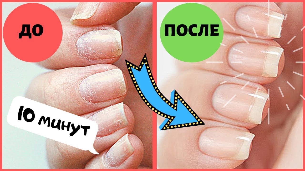 Как восстановить ногти после гель-лака дома?