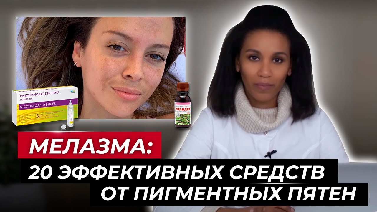 Как избавиться от мелазмы?