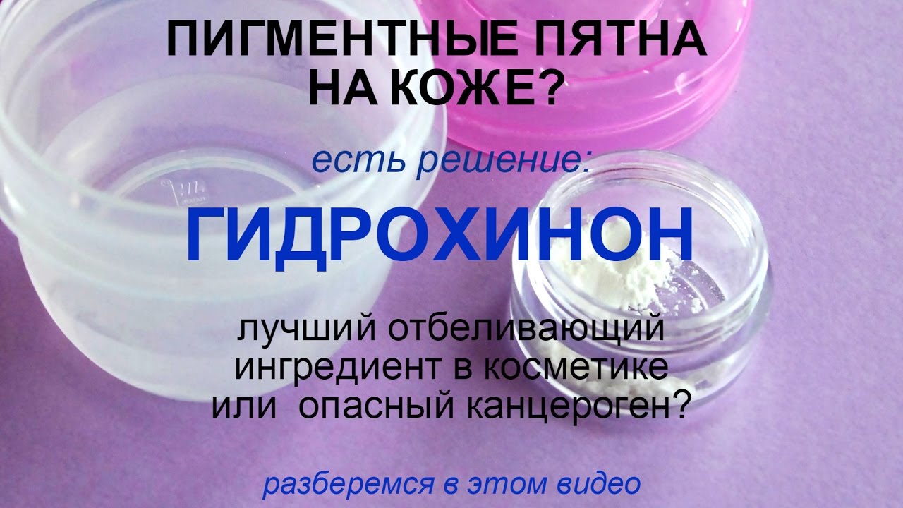 Пигментные пятна: применять гидрохинон или нет?