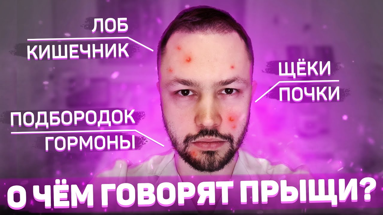Что означает расположение прыщей на лице?