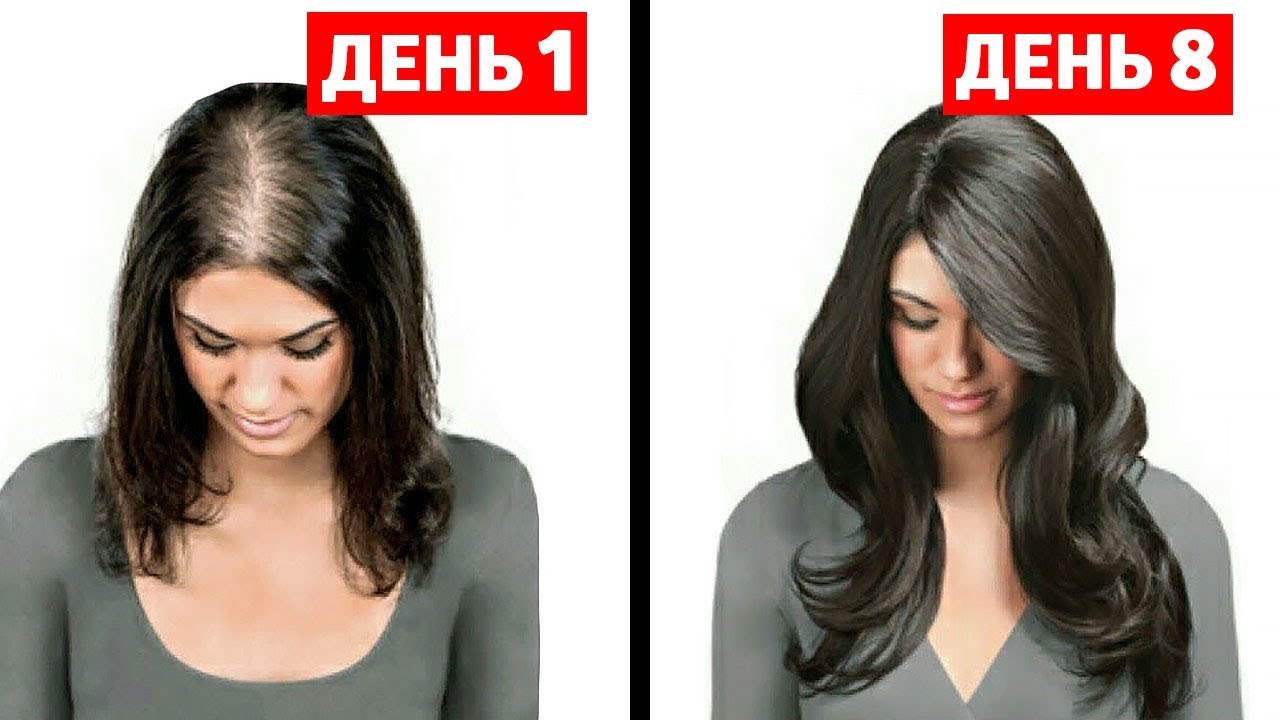 Домашние маски от выпадения волос