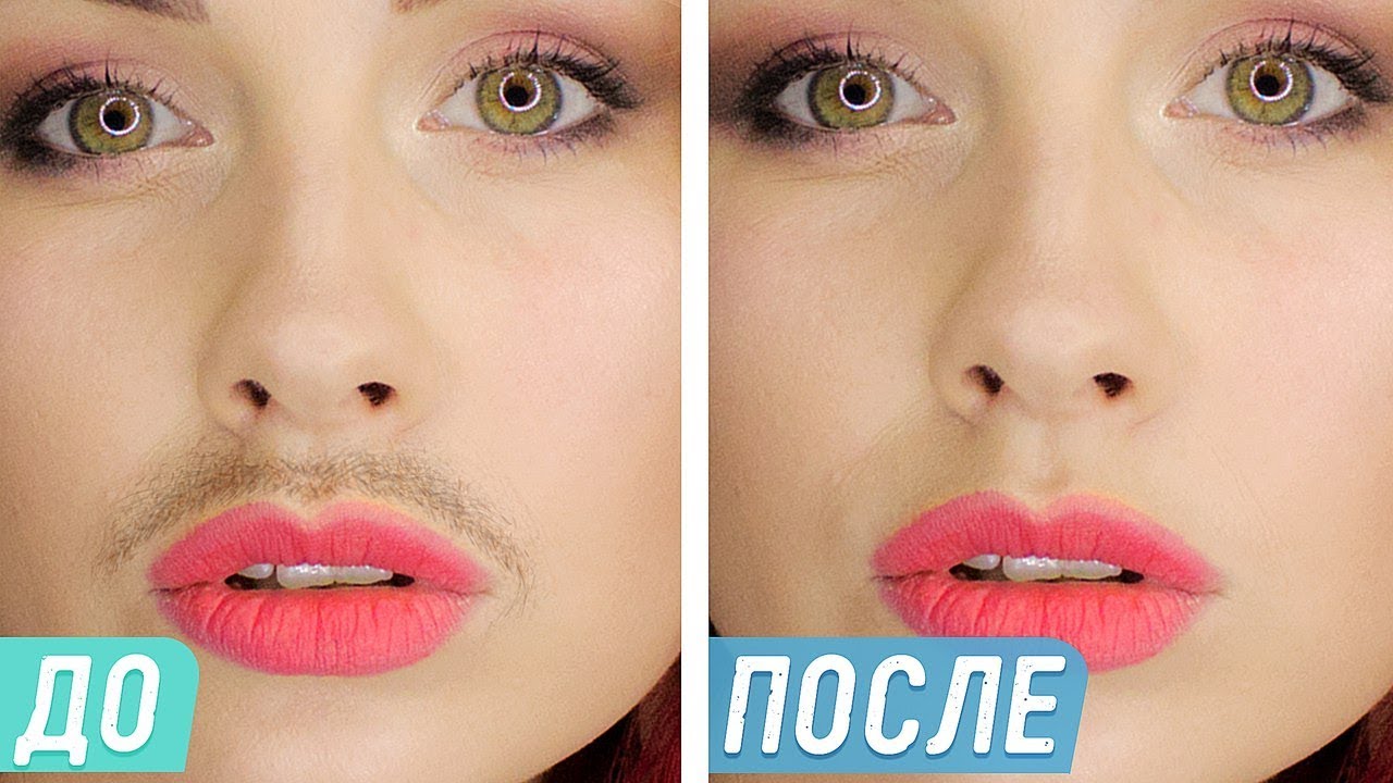 Как убрать женские усики?