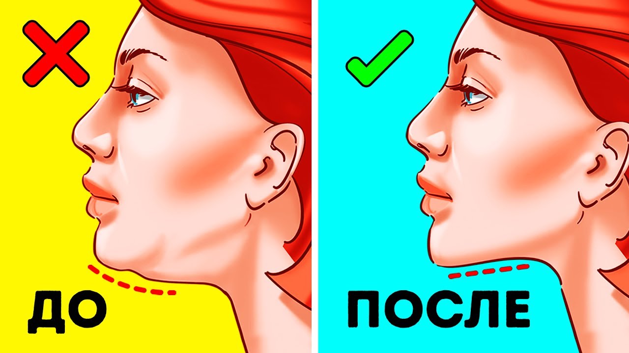 Как избавиться от второго подбородка?