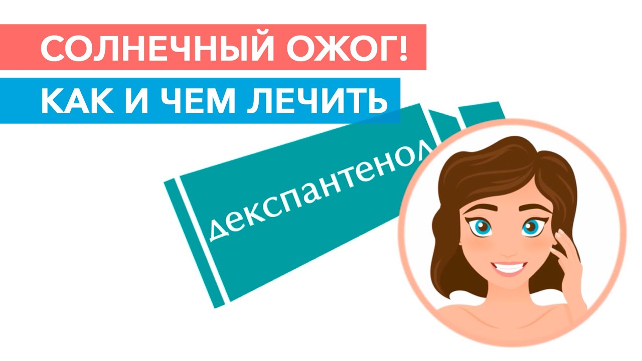 Как лечить ожоги от солнца в домашних условиях?