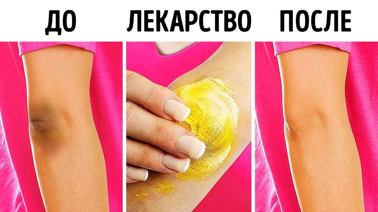 Как осветлить колени и локти?