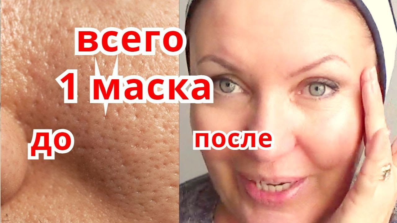 Маска от расширенных пор на коже лица