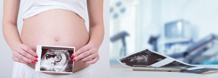 Как рассчитать срок беременности по УЗИ? Как рассчитать срок беременности по УЗИ?