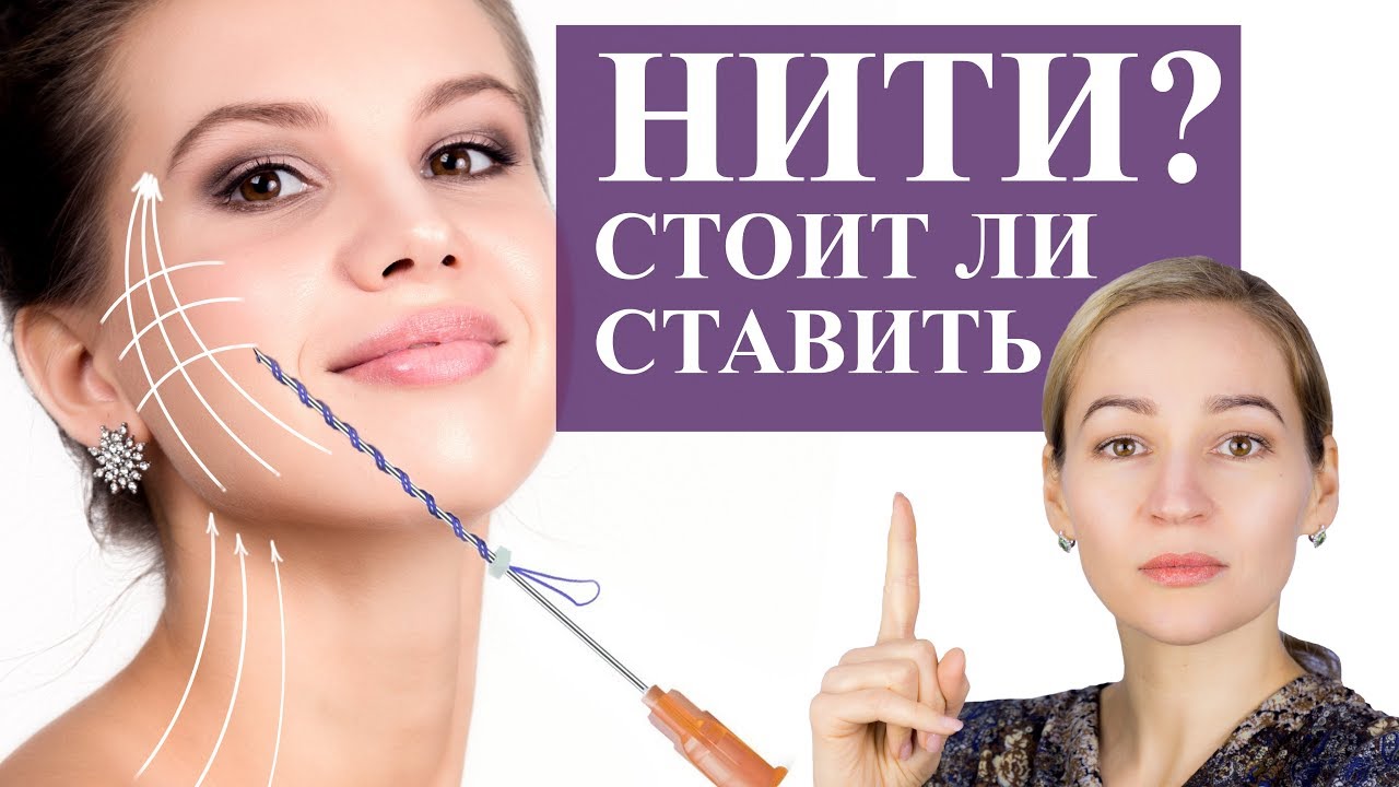Нити для подтяжки лица