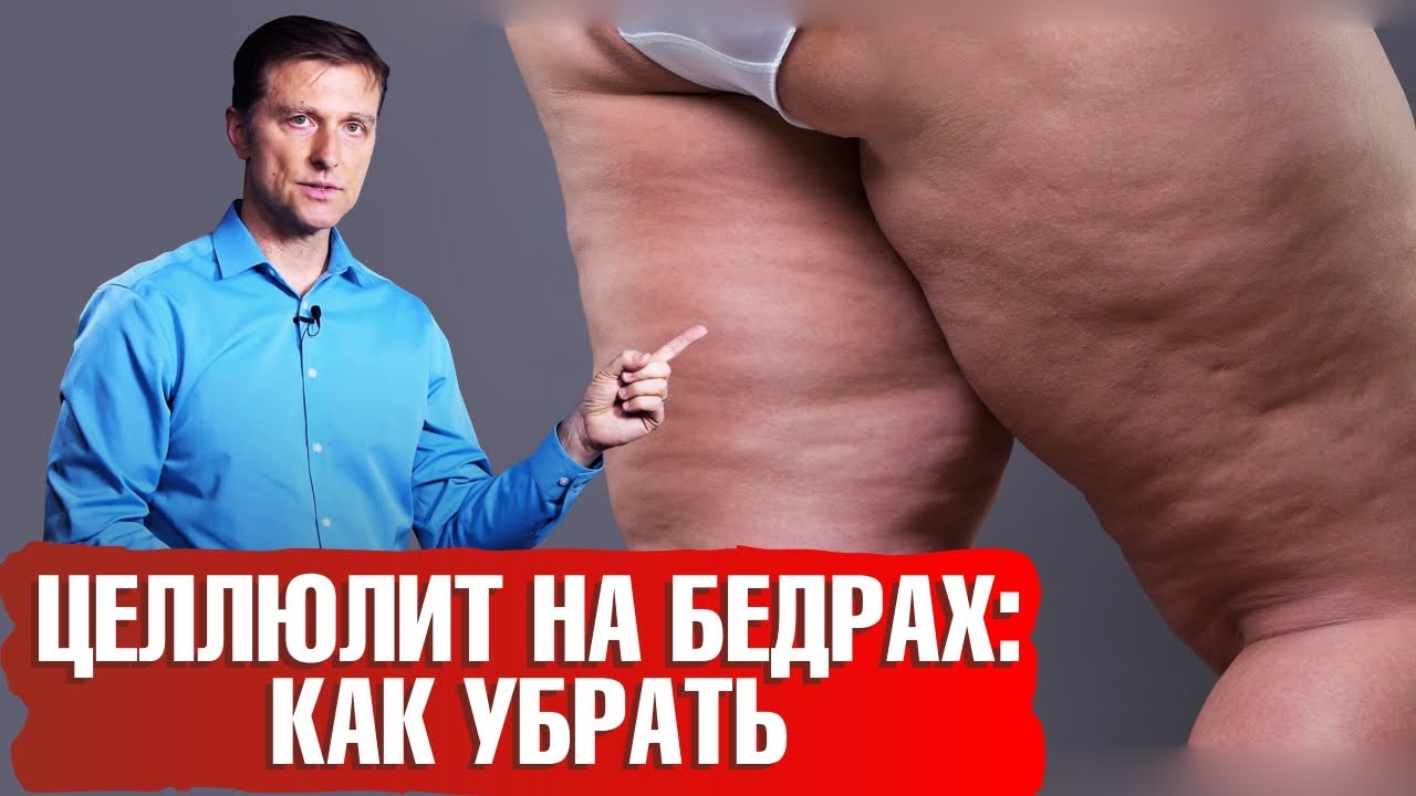 Как избавиться от целлюлита