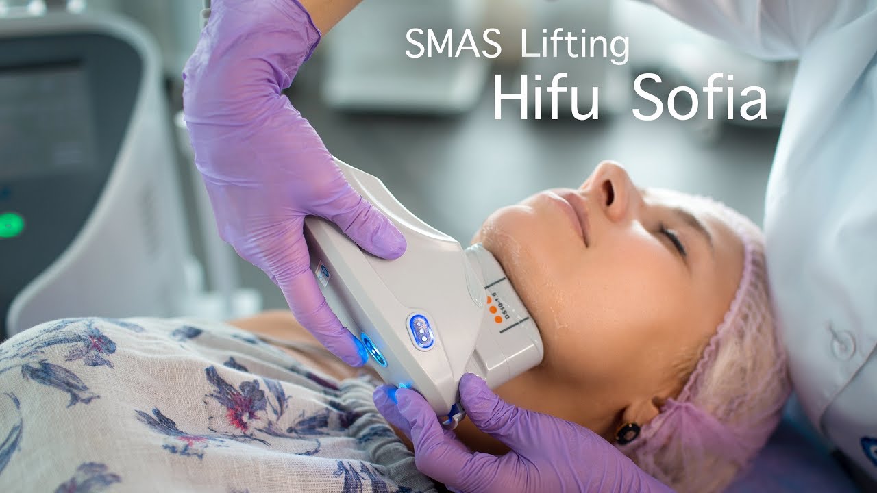 SMAS лифтинг аппаратом HIFU