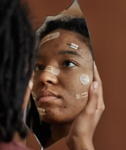 девушка с пластырями на лице